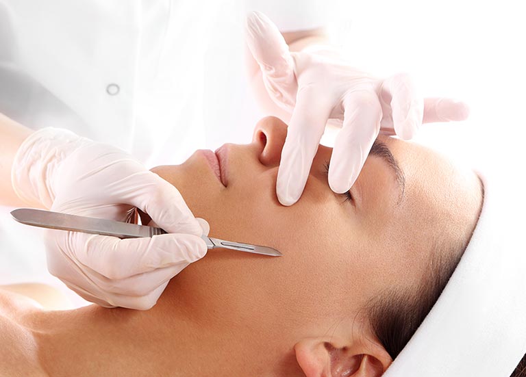 dermaplaning